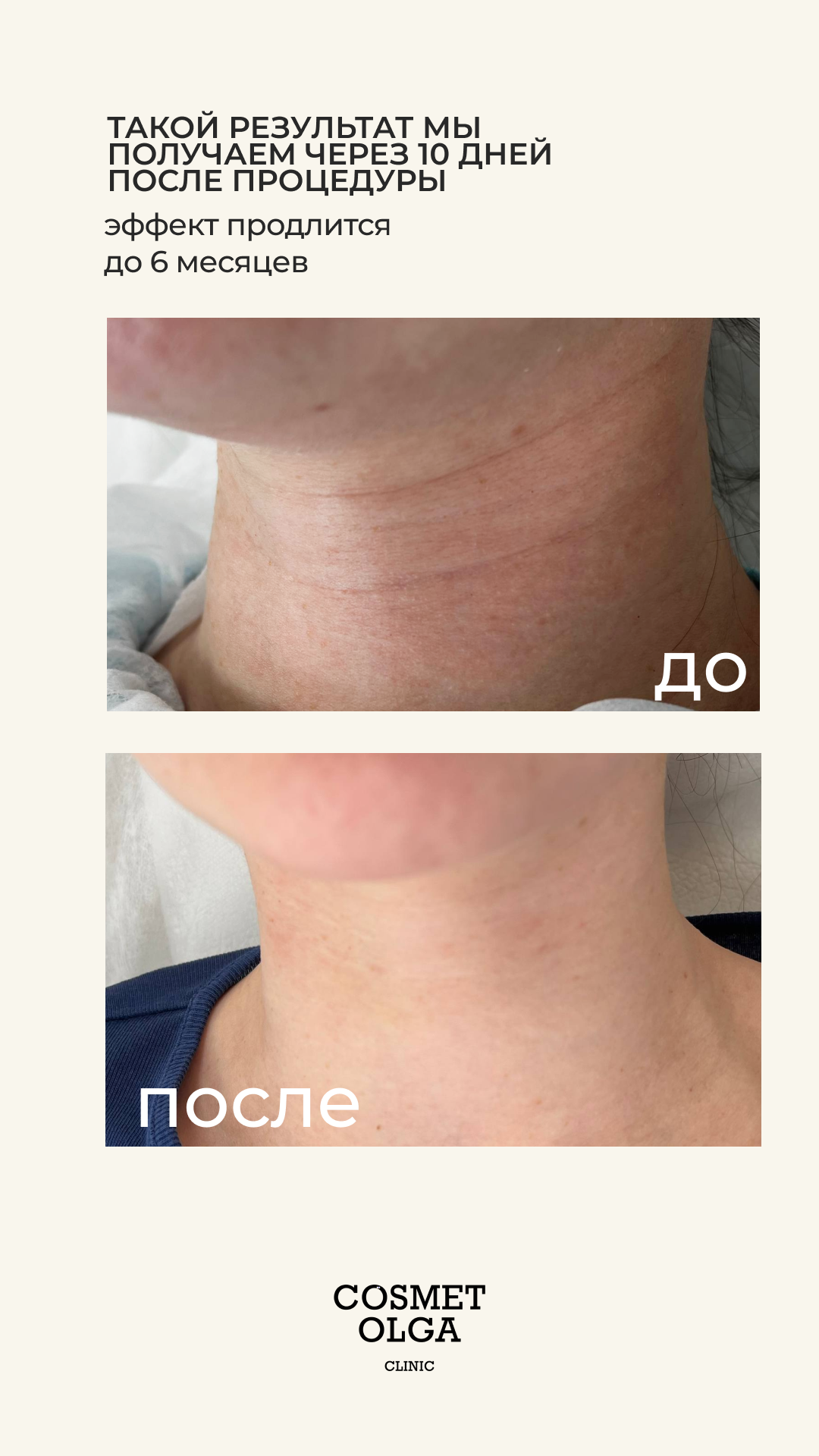 Другие процедуры