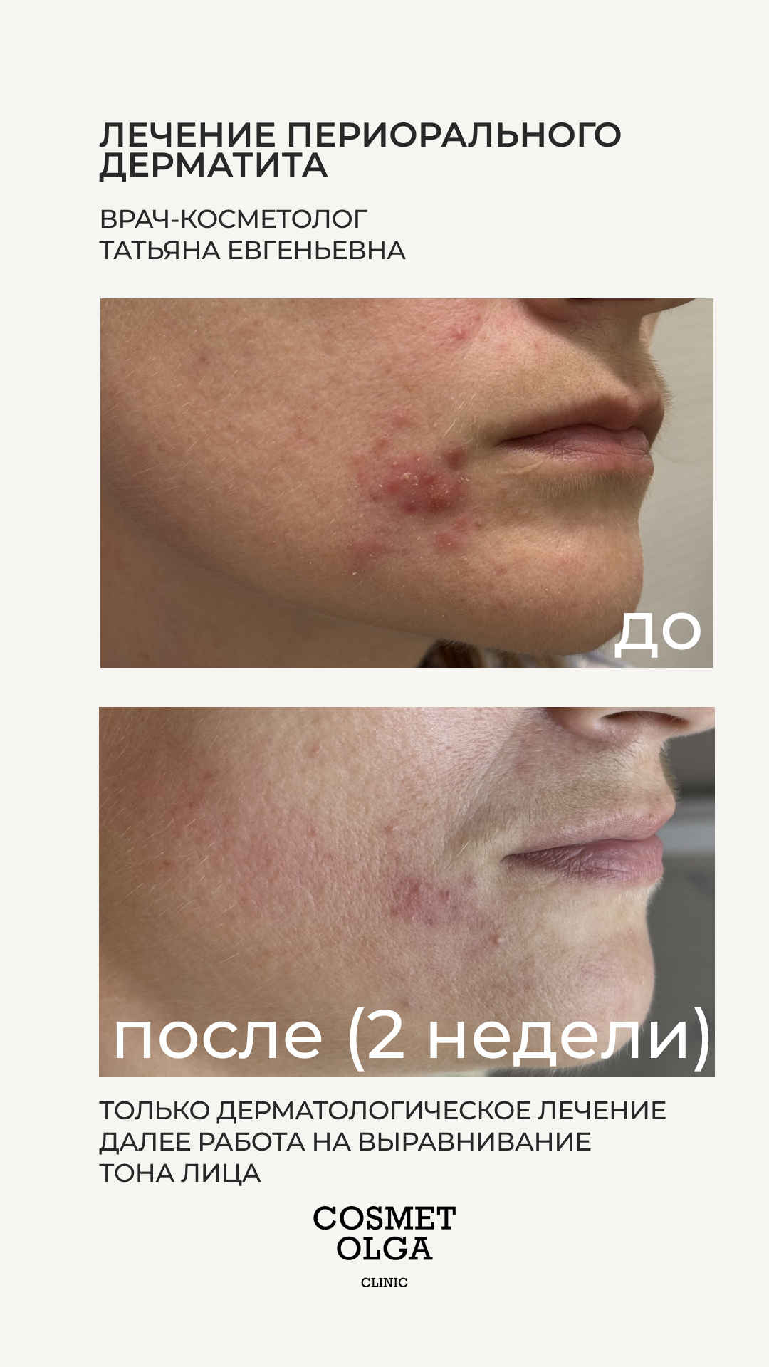 Другие процедуры